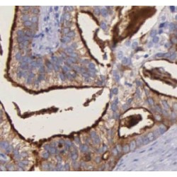 Biliverdin Reductase A (BLVRA) Antibody