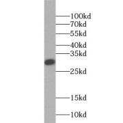 WB analysis of human brain tissue, using BLVRA antibody (1/1000 dilution).