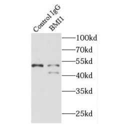 Polycomb Complex Protein BMI-1 (BMI1) Antibody