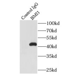 Polycomb Complex Protein BMI-1 (BMI1) Antibody