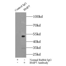 Bone Morphogenetic Protein 7 (BMP7) Antibody