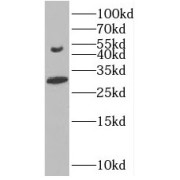 WB analysis of L02 cells, using BMP9 antibody (1/300 dilution).