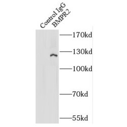 Bone Morphogenetic Protein Receptor 2 (BMPR2) Antibody