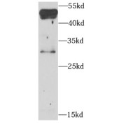 WB analysis of A549 cells, using BNIP3L antibody (1/1000 dilution).