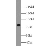 WB analysis of HeLa cells, using BORIS antibody (1/1000 dilution).