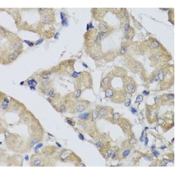 Bisphosphoglycerate Mutase (BPGM) Antibody