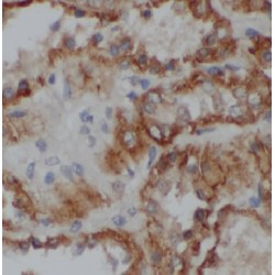 Valacyclovir Hydrolase (BPHL) Antibody