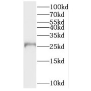 WB analysis of human kidney tissue, using BPHL antibody (1/500 dilution).