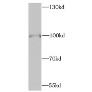 WB analysis of HepG2 cells, using BRAF antibody (1/1000 dilution).