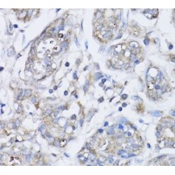 Breast Cancer Type 1 Susceptibility Protein (BRCA1) Antibody