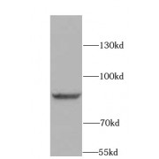 WB analysis of human testis tissue, using BRCA1 antibody (1/1000 dilution).