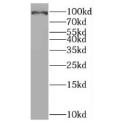 WB analysis of human testis tissue, using BRCA1 antibody (1/1000 dilution).