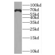WB analysis of MCF7 cells, using BRCC3 antibody (1/300 dilution).