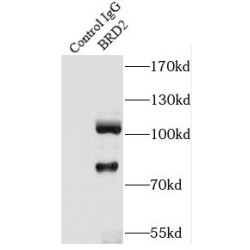 Bromodomain-Containing Protein 2 (BRD2) Antibody