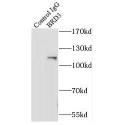 Bromodomain-Containing Protein 3 (BRD3) Antibody