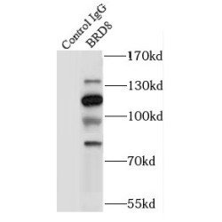 Bromodomain-Containing Protein 8 (BRD8) Antibody