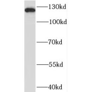 WB analysis of HeLa cells, using BRD8 antibody (1/500 dilution).