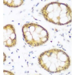 Bromodomain-Containing Protein 9 (BRD9) Antibody