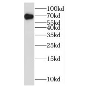 WB analysis of HeLa cells, using BRD9 antibody (1/1000 dilution).