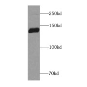 WB analysis of human brain tissue, using Brevican antibody (1/500 dilution).