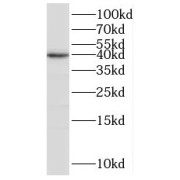 WB analysis of MCF-7 cells, using BRMS1L antibody (1/600 dilution).