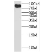 WB analysis of mouse brain tissue, using BRSK2 antibody (1/500 dilution).