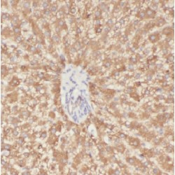 Bone Marrow Stromal Antigen 2 (BST2) Antibody