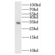 WB analysis of human heart tissue, using BST2 antibody (1/1000 dilution).