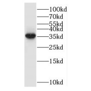 WB analysis of HeLa cells, using BXDC1 antibody (1/500 dilution).