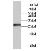 WB analysis of ROS1728 cells, using C10orf58 antibody (1/300 dilution).