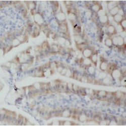 Chromosome 11 Open Reading Frame 49 (CSTPP1) Antibody