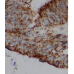 C12orf69 Antibody