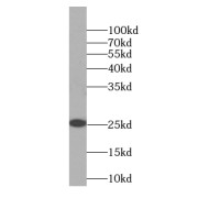 WB analysis of mouse brain tissue, using C12orf69 antibody (1/600 dilution).