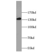 WB analysis of MCF-7 cells, using C14orf102 antibody (1/600 dilution).