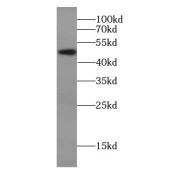 WB analysis of PC-3 cells, using C14orf138 antibody (1/300 dilution).