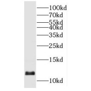 WB analysis of PC-3 cells, using C14orf156 antibody (1/600 dilution).