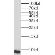 WB analysis of PC-3 cells, using C16orf61 antibody (1/600 dilution).