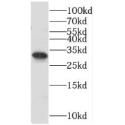 WB analysis of HeLa cells, using C16orf72 antibody (1/300 dilution).