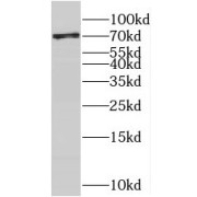 WB analysis of HeLa cells, using C17orf85 antibody (1/1000 dilution).