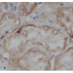 Chromosome 1 Open Reading Frame 50 (C1orf50) Antibody