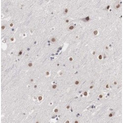 C1orf83 Antibody