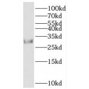 WB analysis of HEK-293 cells, using C20orf11 antibody (1/1000 dilution).