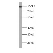 WB analysis of HeLa cells, using NCRNA00153 antibody (1/1000 dilution).