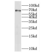 WB analysis of mouse skeletal muscle tissue, using C3orf39 antibody (1/600 dilution).