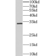 WB analysis of SKOV-3 cells, using C4orf49 antibody (1/1000 dilution).
