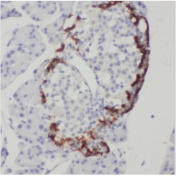 Chromosome 5 Open Reading Frame 24 (C5orf24) Antibody