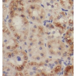 Trafficking Protein Particle Complex Subunit 13 (C5orf44) Antibody