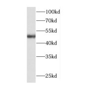 WB analysis of HEK-293 cells, using C5orf44 antibody (1/500 dilution).