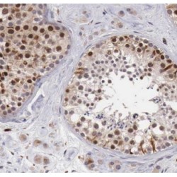 C9orf78 Antibody