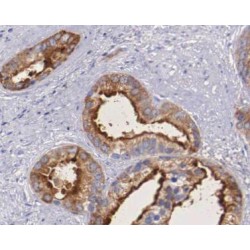 Carbonic Anhydrase 9 (CA IX) Antibody